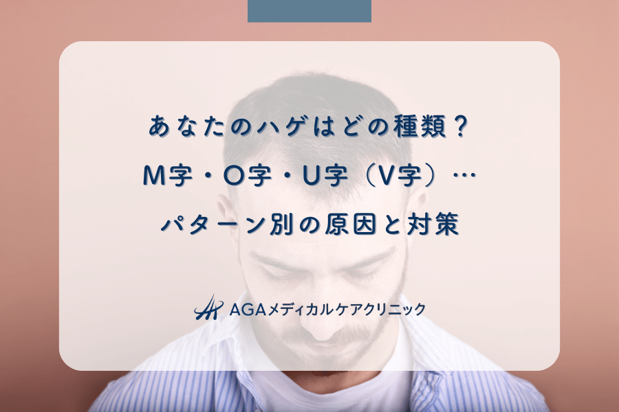 あなたのハゲはどの種類?M字・O字・U字(V字)…パターン別の原因と対策