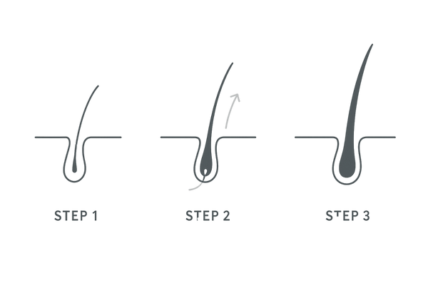 初期脱毛のメカニズム図|弱い毛が抜けて強い新生毛へ置き換わるイメージ(ヘアサイクル正常化)