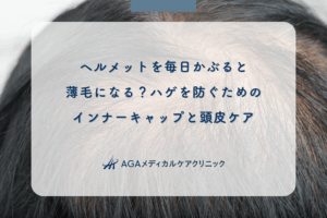 ヘルメットを毎日かぶると薄毛になる?ハゲを防ぐためのインナーキャップと頭皮ケア