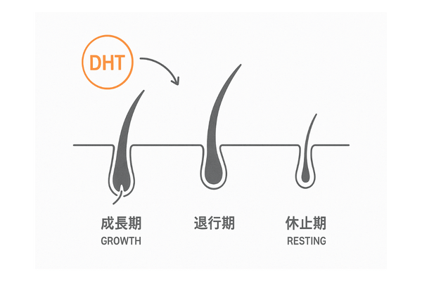 DHTが毛周期を短縮し休止期に移行する流れ|毛周期3ステップ図