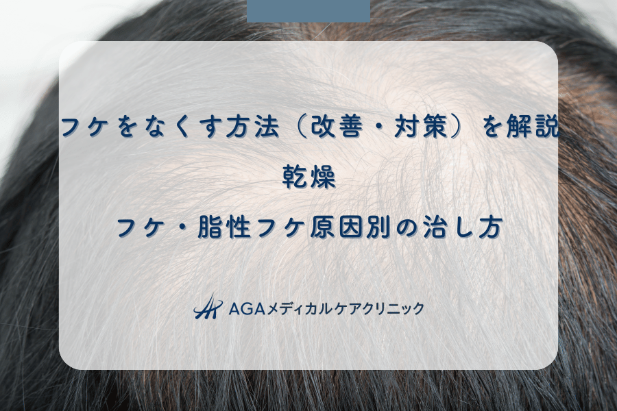 フケをなくす方法(改善・対策)を解説|乾燥フケ・脂性フケ原因別の治し方