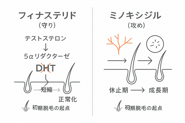フィナステリドとミノキシジルの作用と初期脱毛の違い（守りと攻めの比較図）