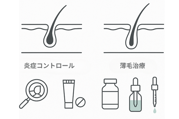 クリニックでの二段階アプローチの可視化（炎症コントロール＋薄毛治療を並行）