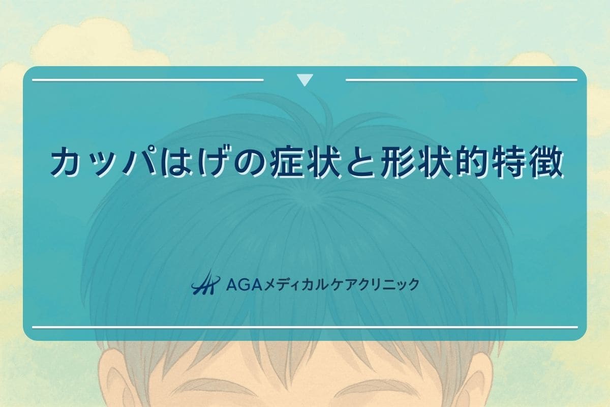 カッパ はげ