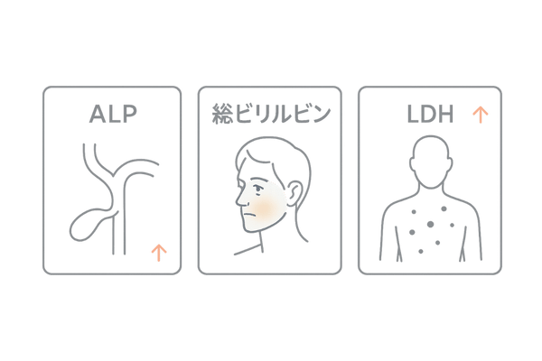 ALP・総ビリルビン・LDHの役割比較｜胆道・黄疸・全身障害の示唆