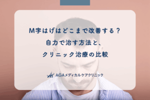 M字はげはどこまで改善する?自力で治す方法と、クリニック治療の比較