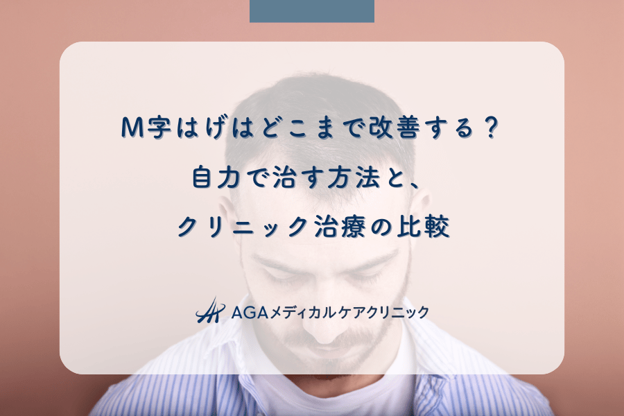 M字はげはどこまで改善する?自力で治す方法と、クリニック治療の比較