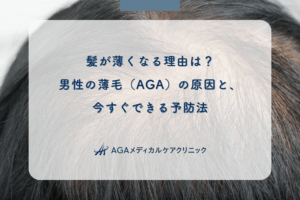 髪が薄くなる理由は?男性の薄毛(AGA)の原因と、今すぐできる予防法