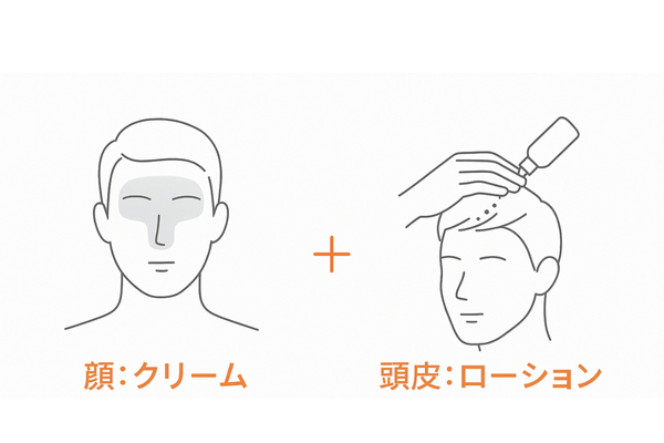 ニゾラールの部位別使い方：顔（クリーム）と頭皮（ローション）の比較図