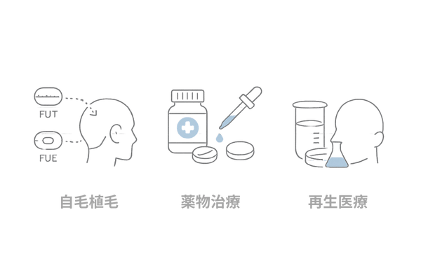 薄毛治療の全体像：自毛植毛・薬物治療・再生医療の比較イメージ