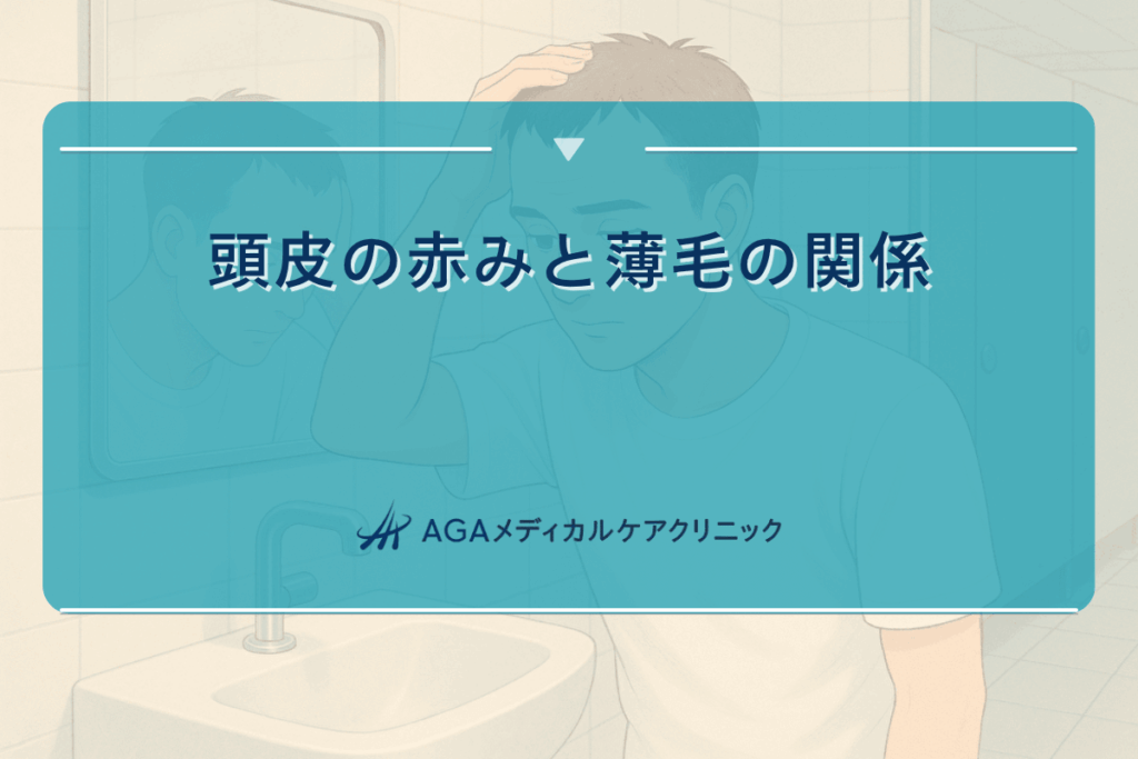 頭皮赤い薄毛, 頭皮赤い抜け毛