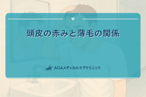 頭皮赤い薄毛, 頭皮赤い抜け毛