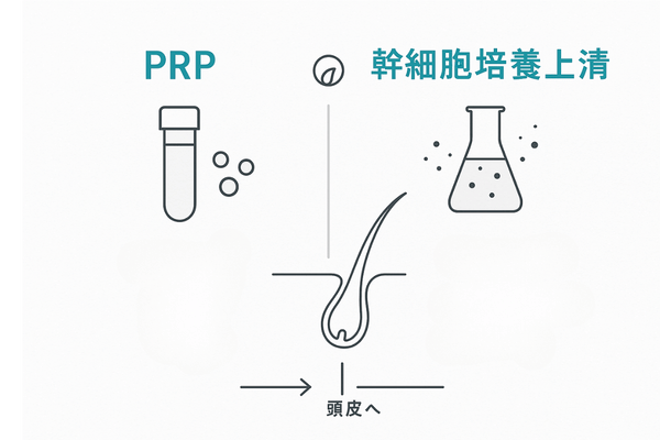 PRPと幹細胞培養上清の違い｜成分と作用の2カラム比較