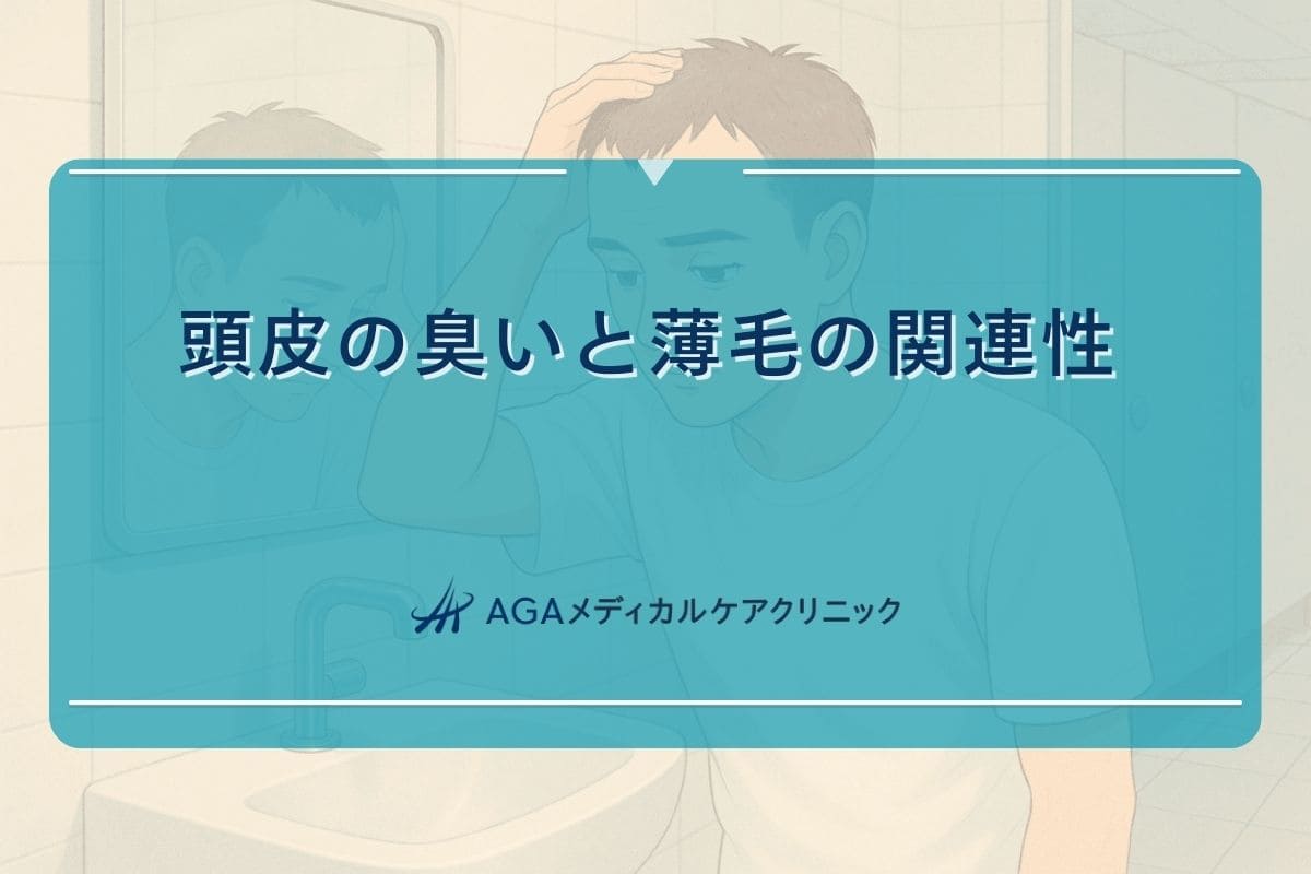 男性 頭皮 臭い