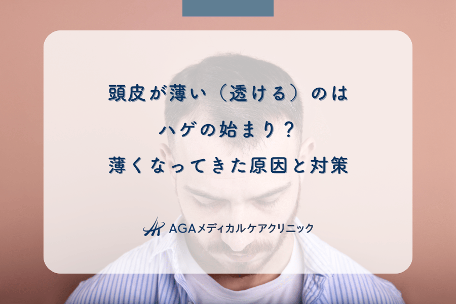 頭皮が薄い（透ける）のはハゲの始まり？薄くなってきた原因と対策