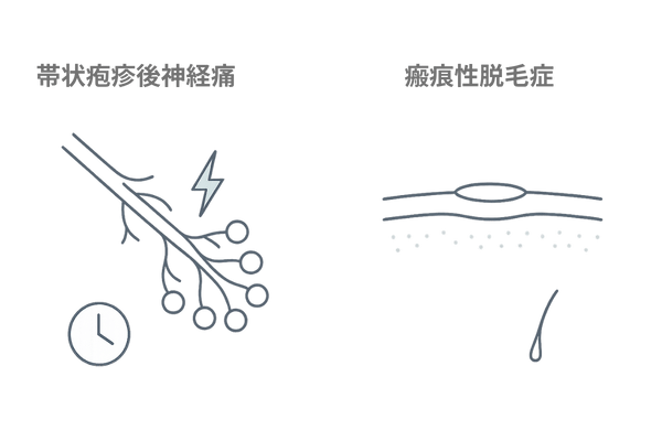 帯状疱疹の放置リスク：帯状疱疹後神経痛と瘢痕性脱毛の概念イメージ