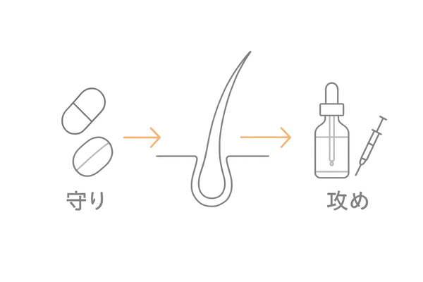 AGA治療の全体像フロー図（守り＝DHT抑制／攻め＝発毛促進）