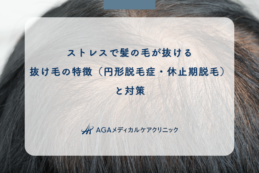ストレスで髪の毛が抜ける!抜け毛の特徴(円形脱毛症・休止期脱毛)と対策