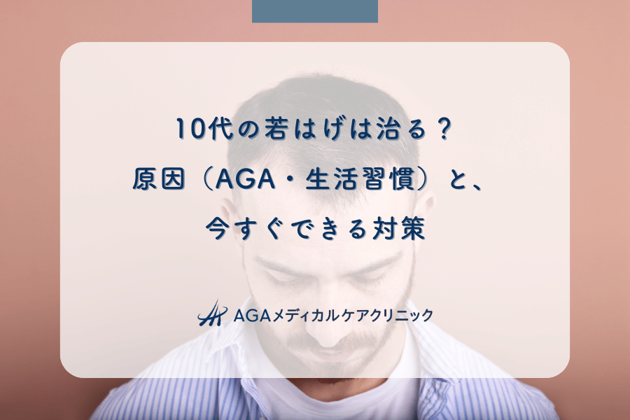 10代の若はげは治る？原因（AGA・生活習慣）と、今すぐできる対策