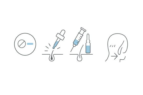こめかみ薄毛の治療オプション比較|内服・外用・注入・植毛