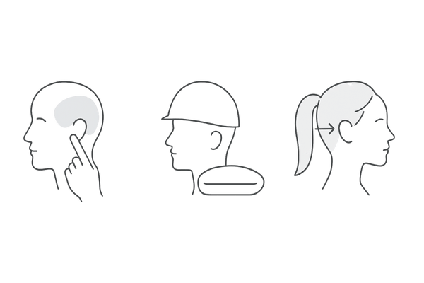 側頭部の薄毛の主な原因比較：筋緊張・物理的圧迫・牽引の影響を示す横長図