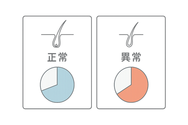 成長期毛と休止期毛の割合｜正常と異常の比較