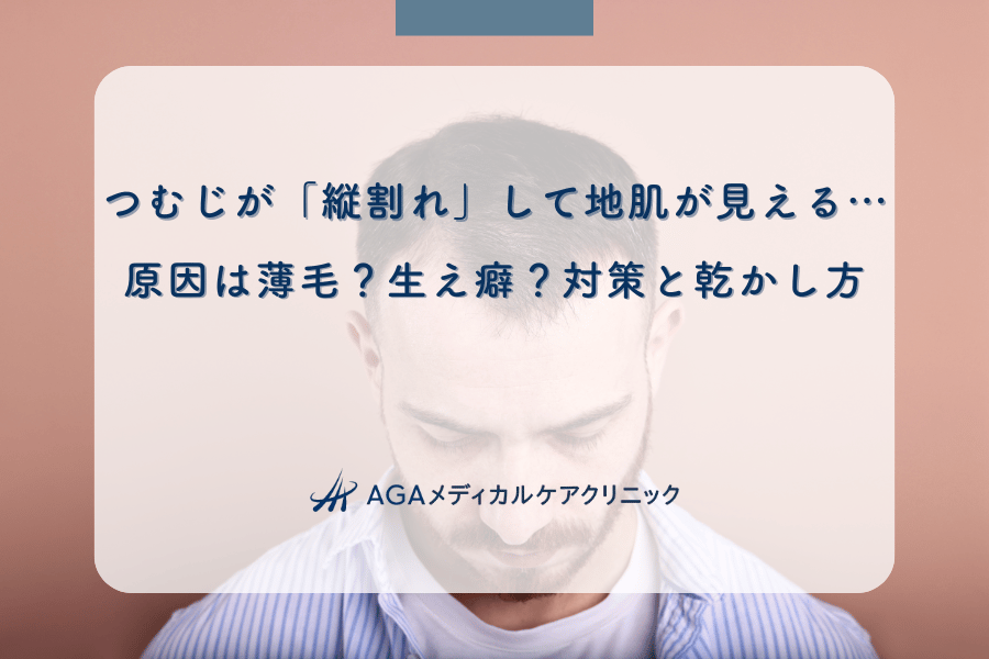 つむじが「縦割れ」して地肌が見える…原因は薄毛？生え癖？対策と乾かし方
