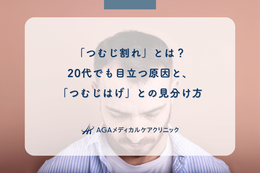 「つむじ割れ」とは？20代でも目立つ原因と、「つむじはげ」との見分け方