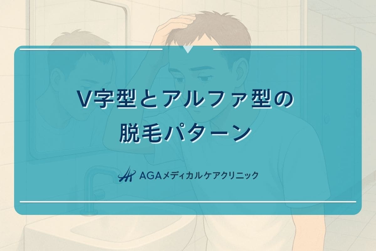 v 字 はげ, アルファ はげ