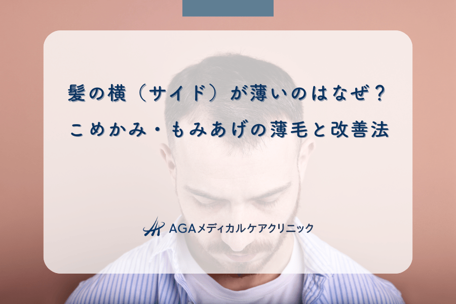 髪の横（サイド）が薄いのはなぜ？こめかみ・もみあげの薄毛と改善法