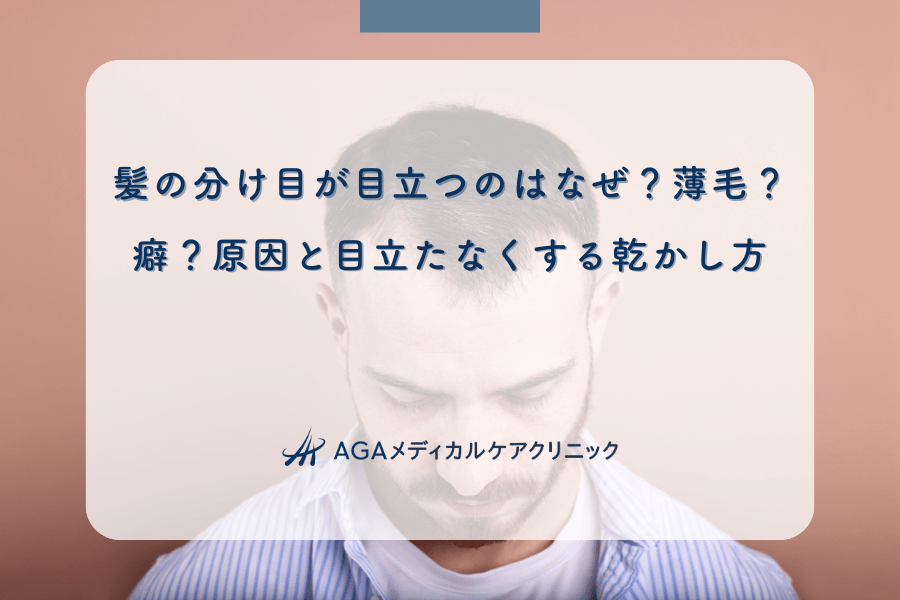 髪の分け目が目立つのはなぜ？薄毛？癖？原因と目立たなくする乾かし方