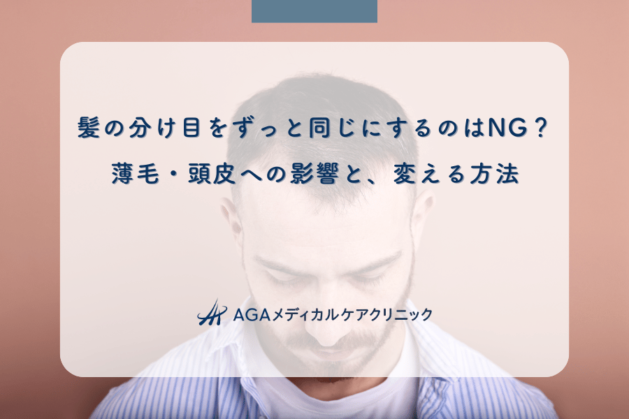 髪の分け目をずっと同じにするのはNG？薄毛・頭皮への影響と、変える方法