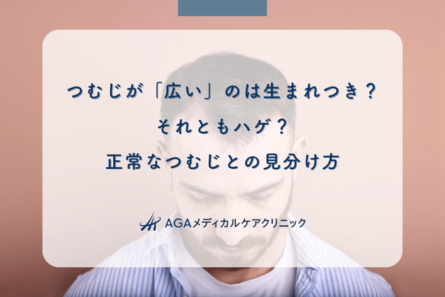つむじが「広い」のは生まれつき？それともハゲ？正常なつむじとの見分け方