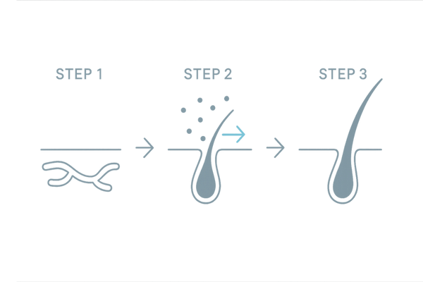 ミノキシジルの発毛メカニズム：毛細血管拡張→栄養供給→毛母細胞活性化