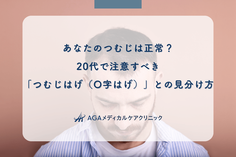 あなたのつむじは正常？20代で注意すべき「つむじはげ（O字はげ）」との見分け方