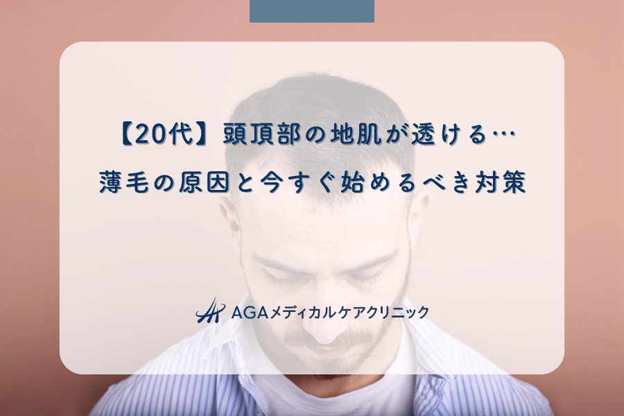 【20代】頭頂部の地肌が透ける…薄毛の原因と今すぐ始めるべき対策
