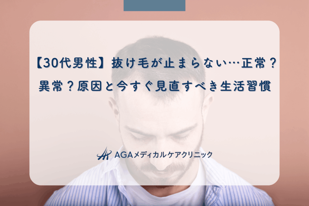 30s-men-hair-loss-causes-lifestyle