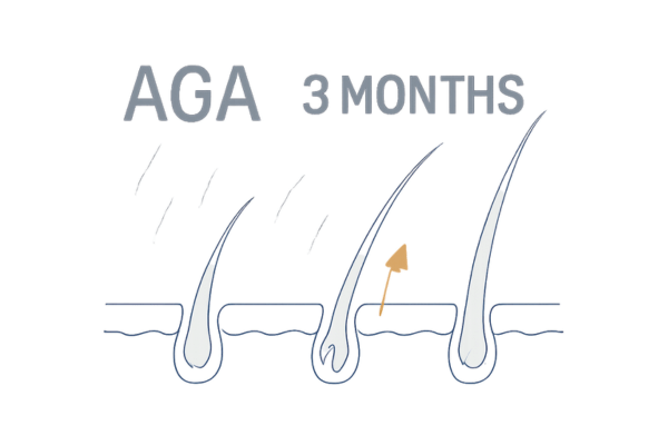 AGA治療初期段階の変化