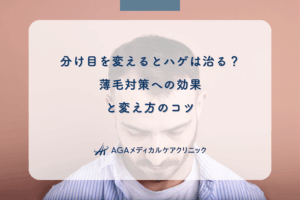 分け目を変えるとハゲは治る？薄毛対策への効果と変え方のコツ
