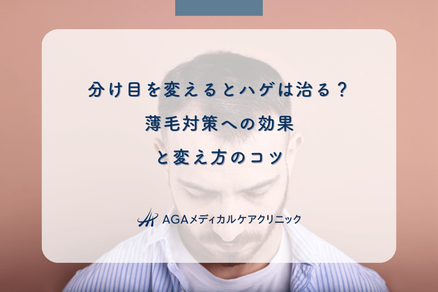 分け目を変えるとハゲは治る？薄毛対策への効果と変え方のコツ