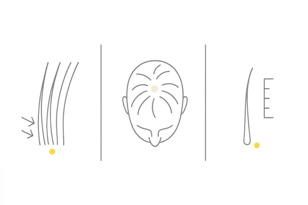 頭頂部ハゲの初期サイン｜セルフチェック用3カラムアイコン図（髪の細化・頭皮の透け・短い抜け毛）