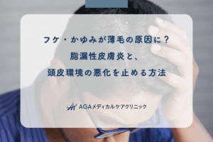 フケ・かゆみが薄毛の原因に？脂漏性皮膚炎と、頭皮環境の悪化を止める方法
