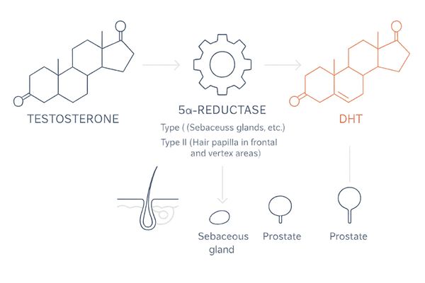 5αリダクターゼでテストステロンがDHTに変換される仕組み（Ⅰ型・Ⅱ型と毛包の関係）