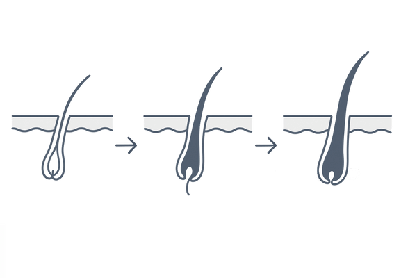 ザガーロ初期脱毛の仕組み｜古い毛が押し出され新しい毛に置き換わる流れ