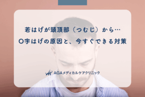 若はげが頭頂部（つむじ）から…O字はげの原因と、今すぐできる対策