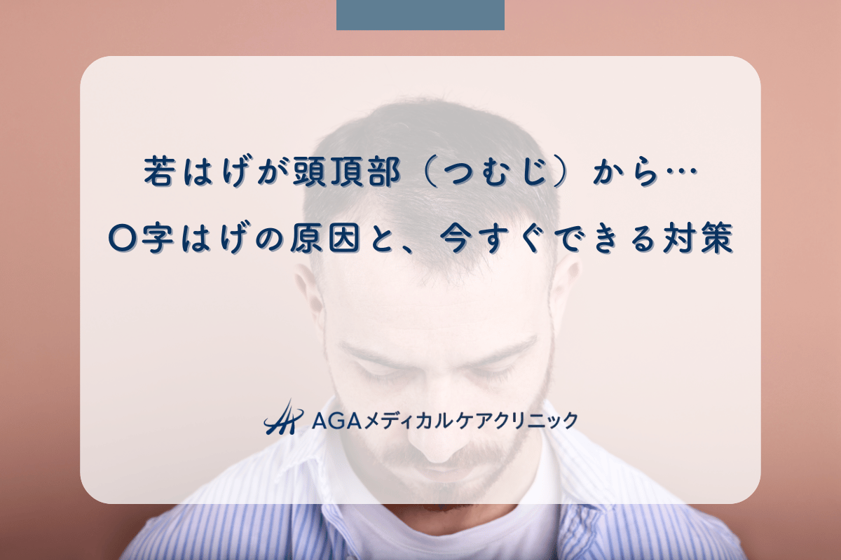 若はげが頭頂部（つむじ）から…O字はげの原因と、今すぐできる対策