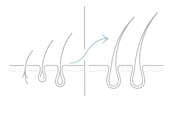フィナステリドがDHTを抑えてヘアサイクルを正常化し抜け毛を予防する仕組みの図解