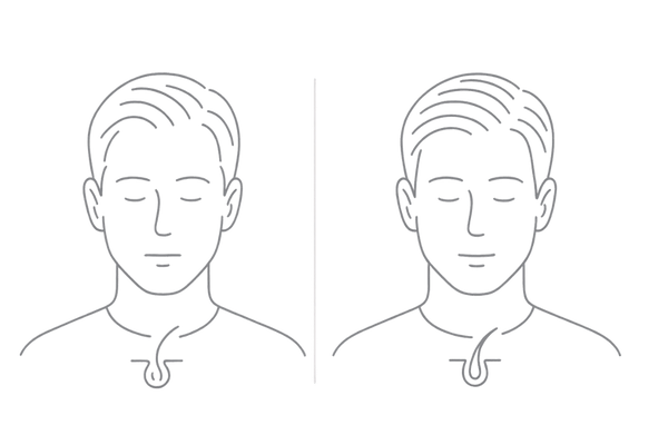 抜け毛減少とハリ・コシ改善(服用3〜6ヶ月)の2コマ比較