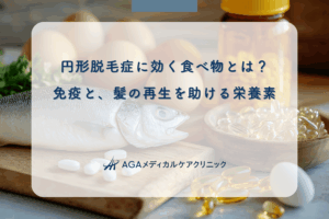 円形脱毛症に効く食べ物とは？免疫と、髪の再生を助ける栄養素