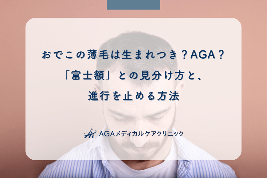 おでこの薄毛は生まれつき？AGA？「富士額」との見分け方と、進行を止める方法